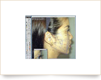 セファロ分析画像処理ソフト